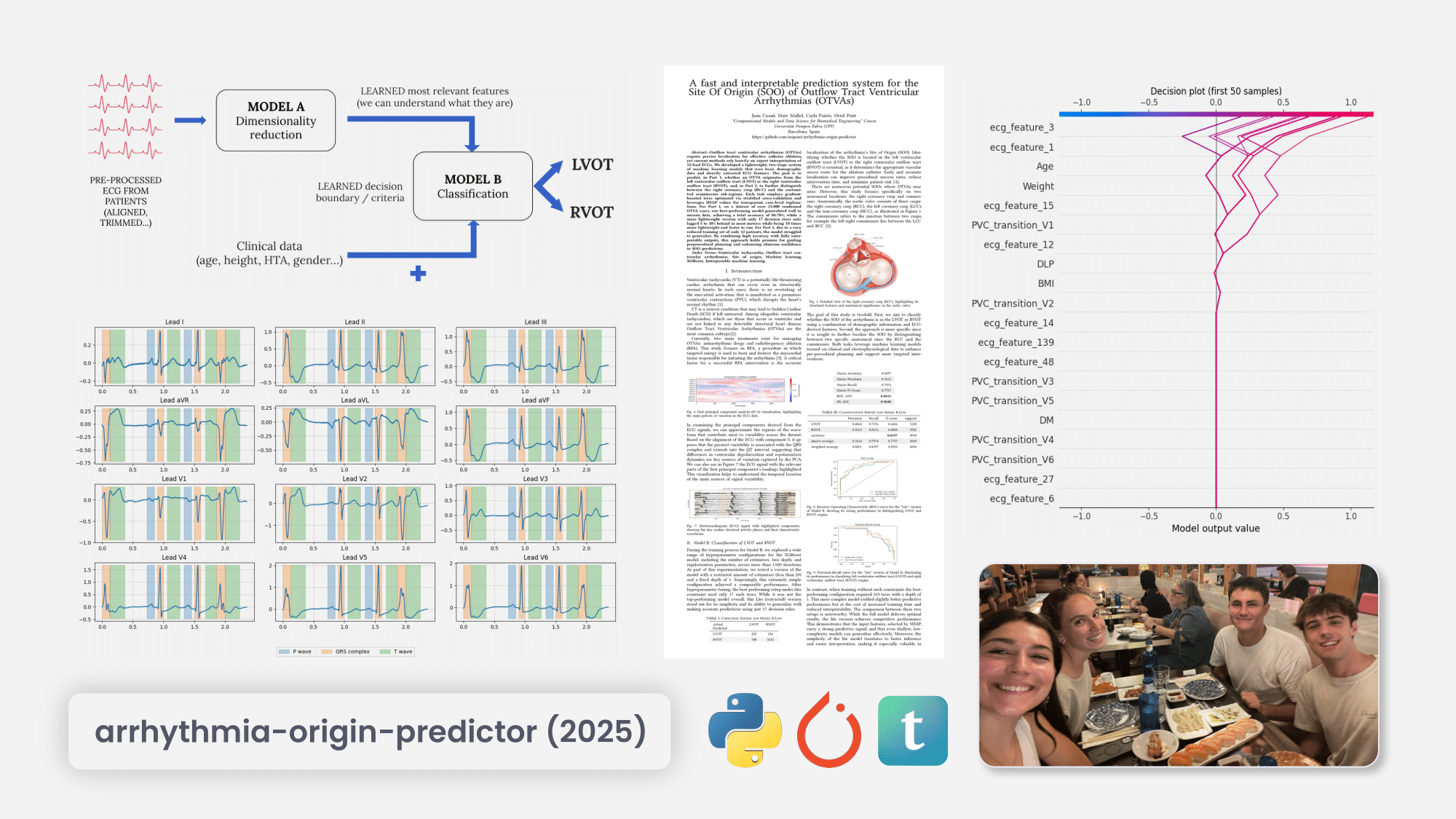 Arrythmia predictor project overview